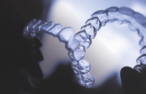 What are Clear Aligners, and Can They Help Me?
